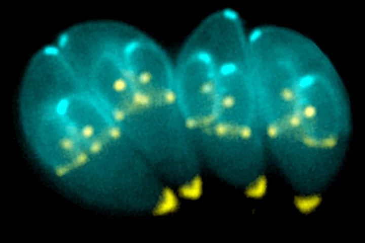 Infection with the T. gondii parasite has been correlated with an increase in risky behaviours – perhaps even such as starting a new business