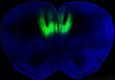 The green fluorescence indicates the firing of neurons, in the prefrontal cortex of one of the rats