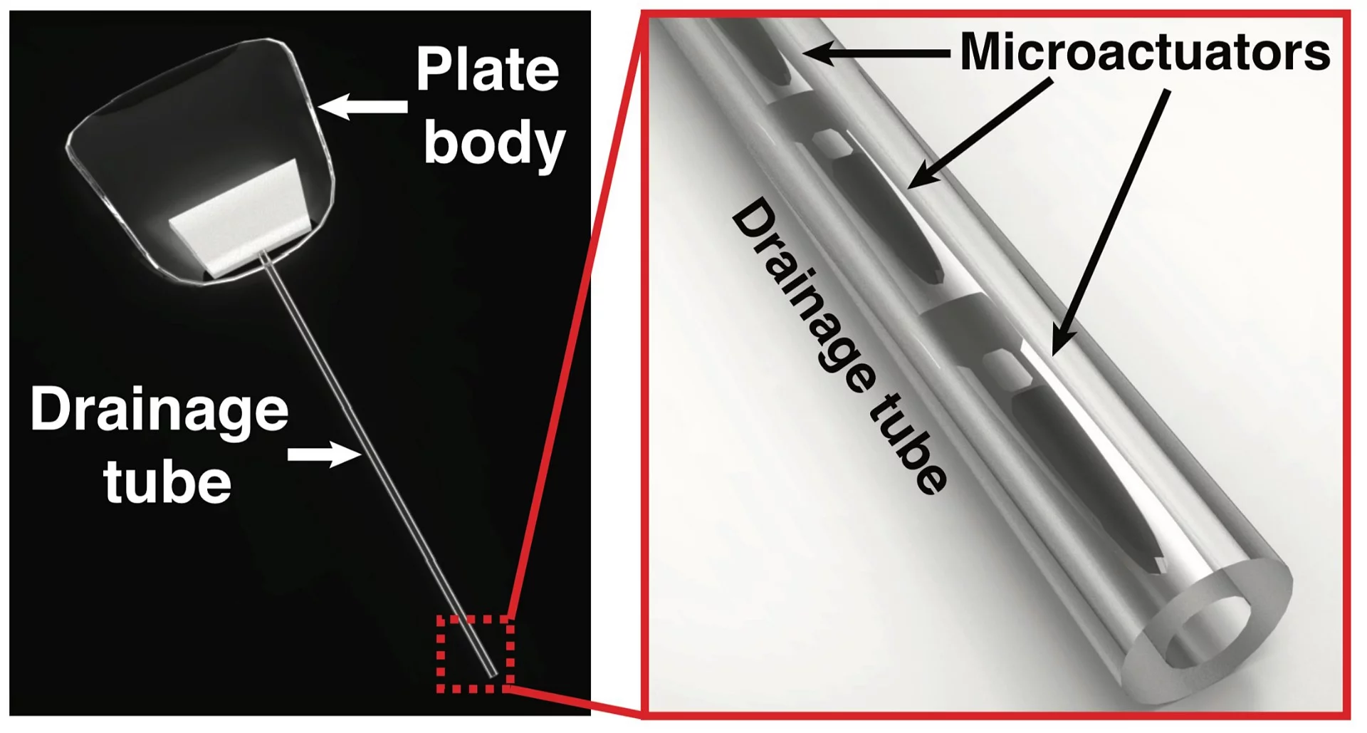 The implant is activated via externally-applied magnetic fields