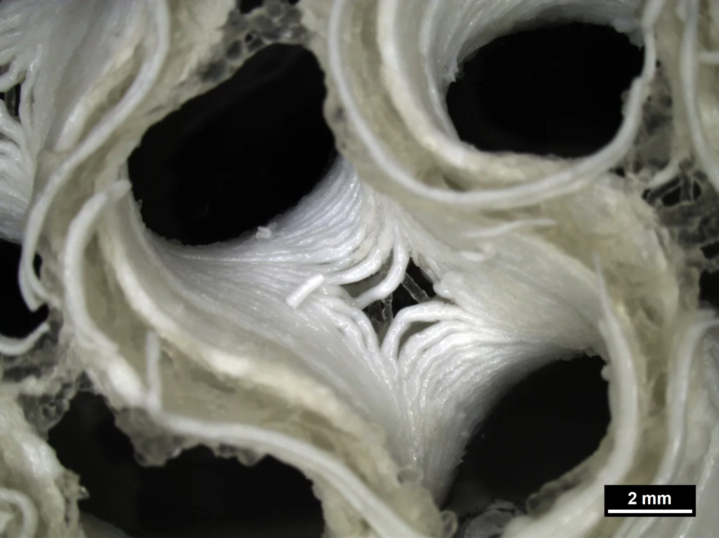 A microscope image of new bioprinted bone growing