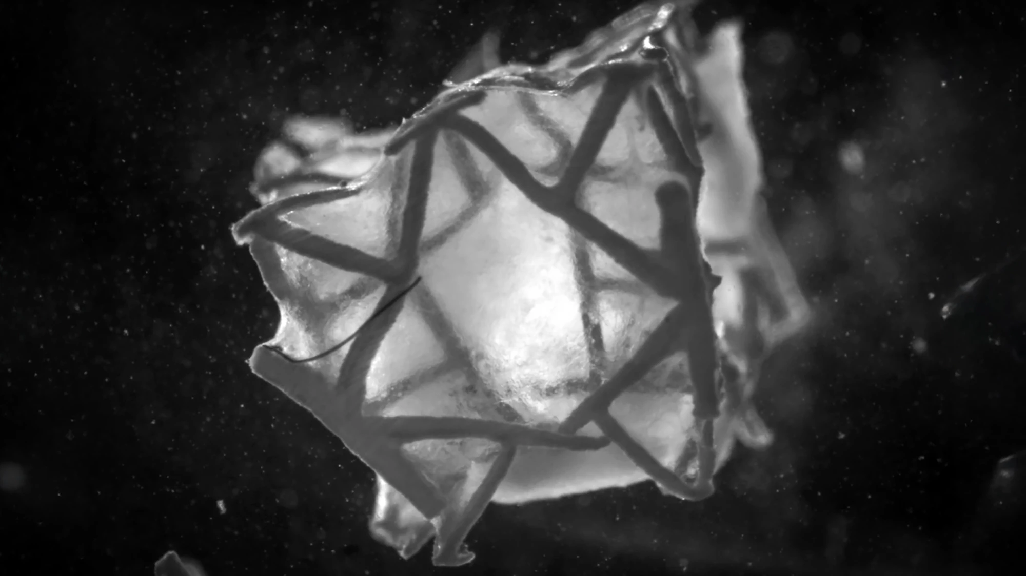 A novel 3D-printed heart patch seals and regenerates