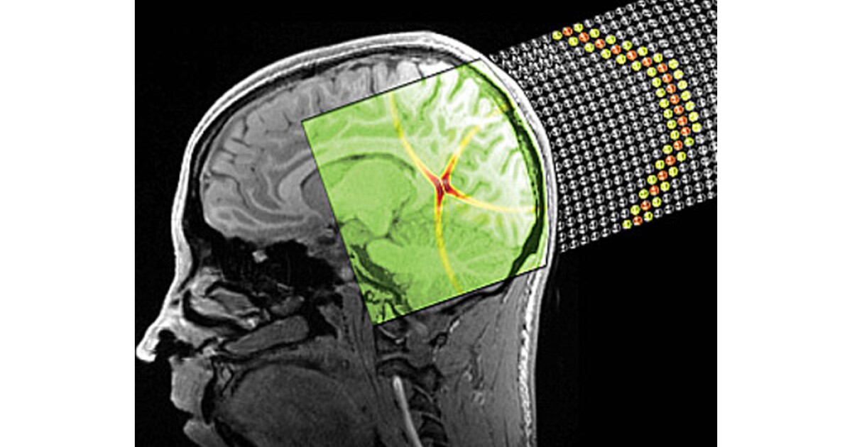 ‘Sound bullets’ aim to improve on ultrasound imaging