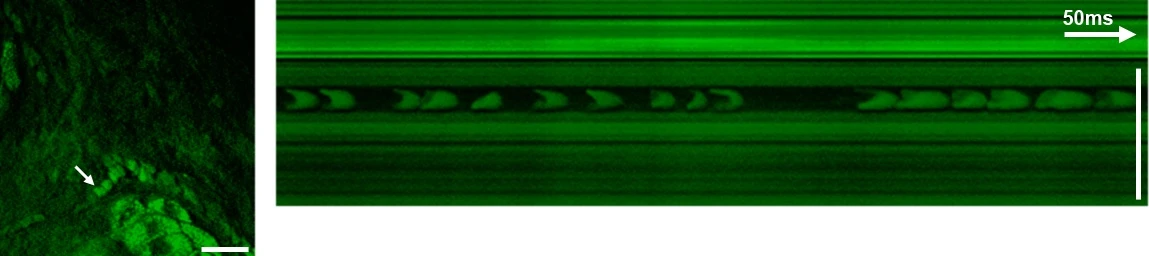 SRS images of the viable epidermis at the CH3-vibration mainly highlight proteins (left). A capillary with individual red blood cells (arrow) is visible. The cells are imaged without motion blur due to video rate acquisition speed. (right) An x-t plot acquired by line-scanning across a capillary at the position of the arrow. Individual red blood cells are captured on the fly. Scale: 25 Î¼m (Image: Dr. Brian Saar and Christian Freudiger)