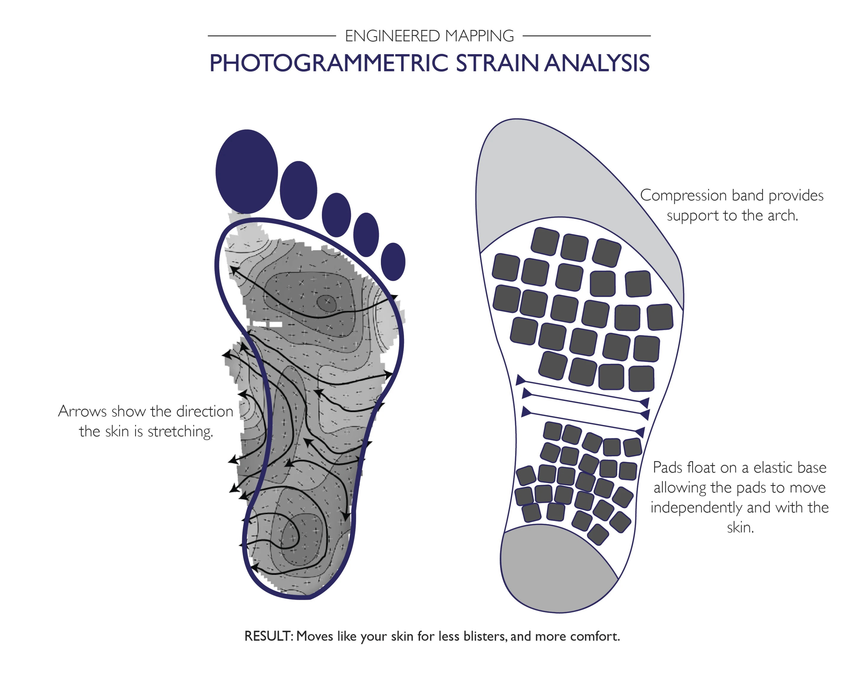 Pressure mapping locates pressure points to add support