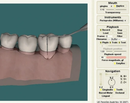4-tooth model section of a lower right jaw