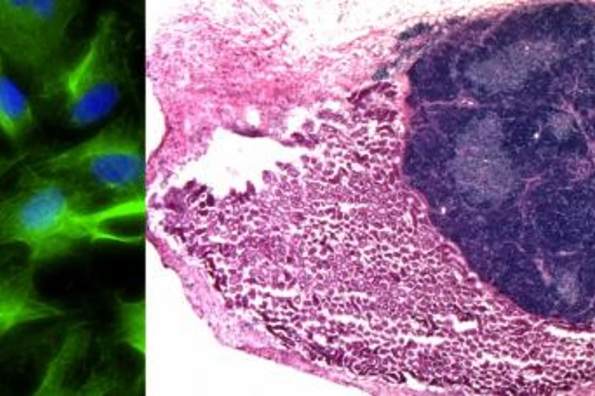 Fibroblasts transplanted onto the mouse kidney form an organised and functional mini-thymus (right, kidney cells in pink, thymus cells in dark blue) (Image: University of Edinburgh)