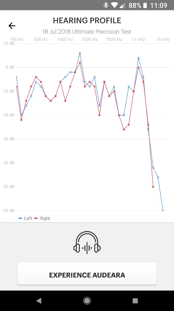 My hearing curve, as measured by the Audeara A-01 system's built-in hearing test