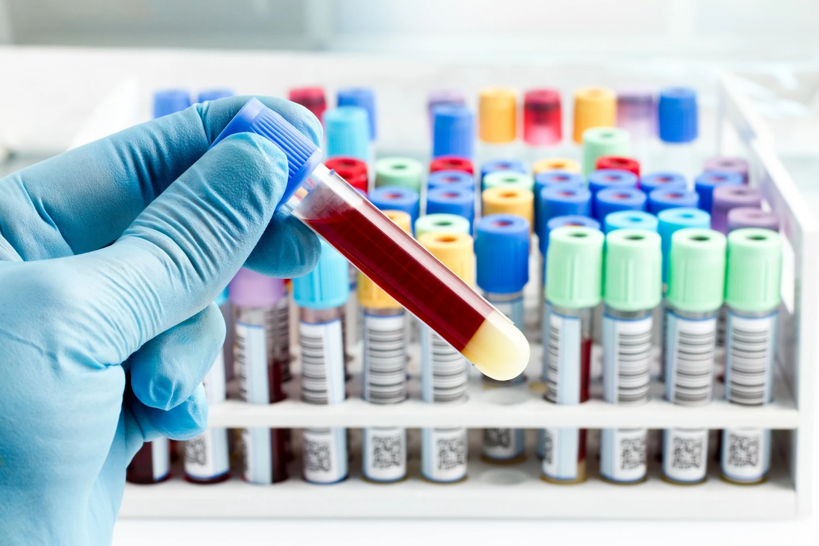 A new blood test that can identify chronic pain could revolutionize diagnoses for humans and animals