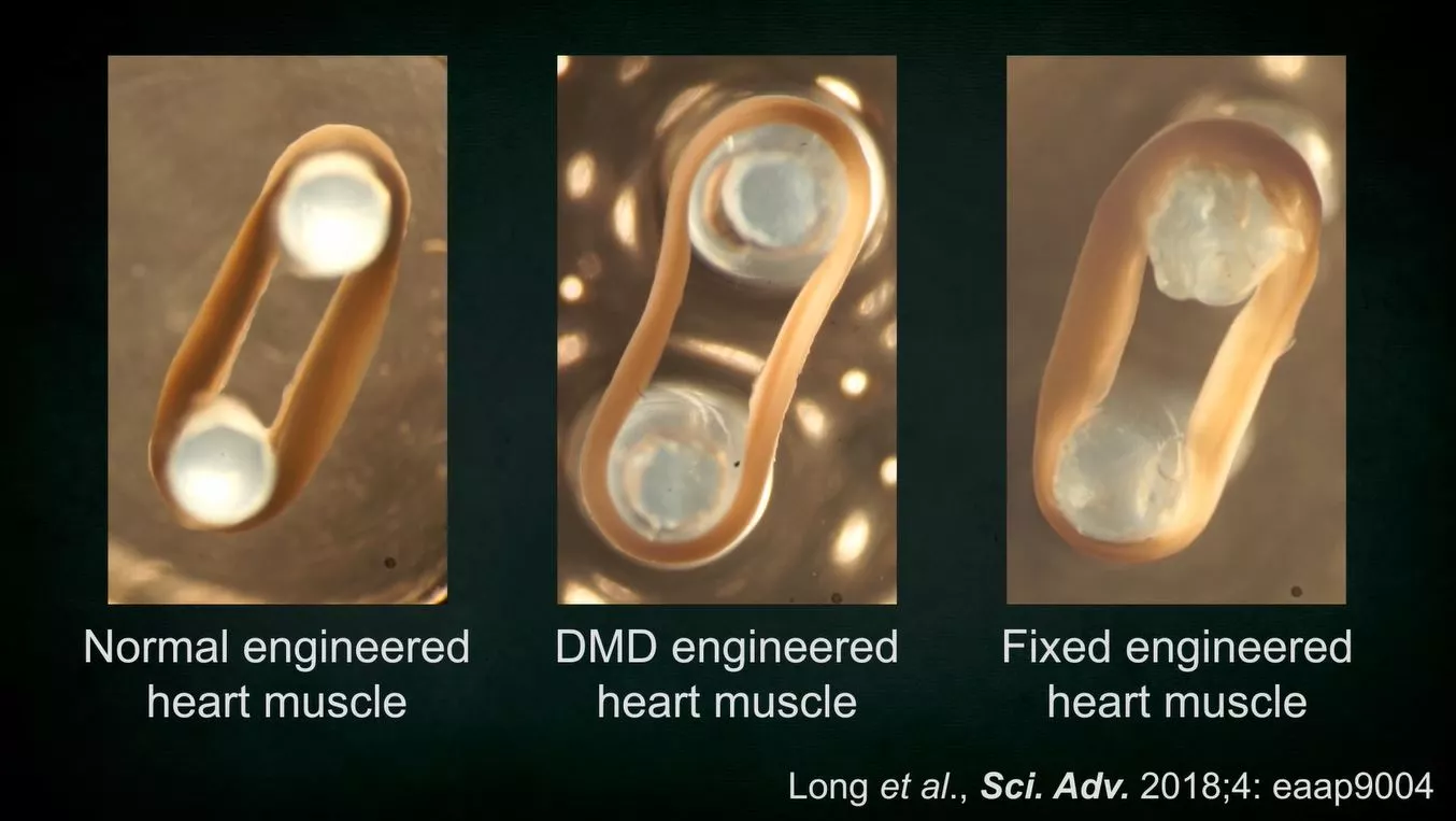 From left to right: the beating function of a healthy heart muscle tissue, DMD heart muscle tissue, and tissue edited by CRISPR-Cas9