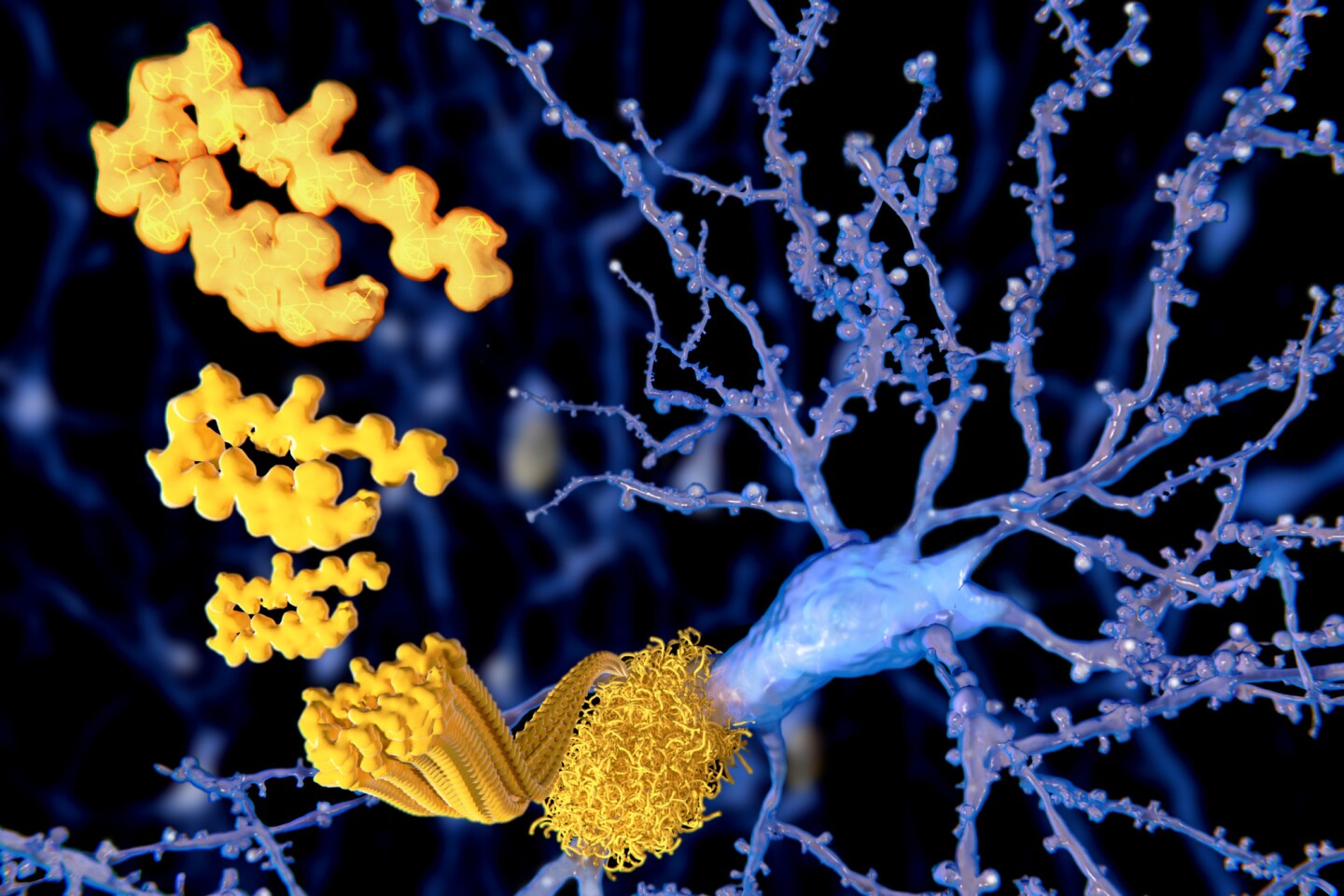 Treatment with a supplementary 'chemical chaperone' has been shown to reduce protein plaques and improve cognitive performance in Alzheimer's disease