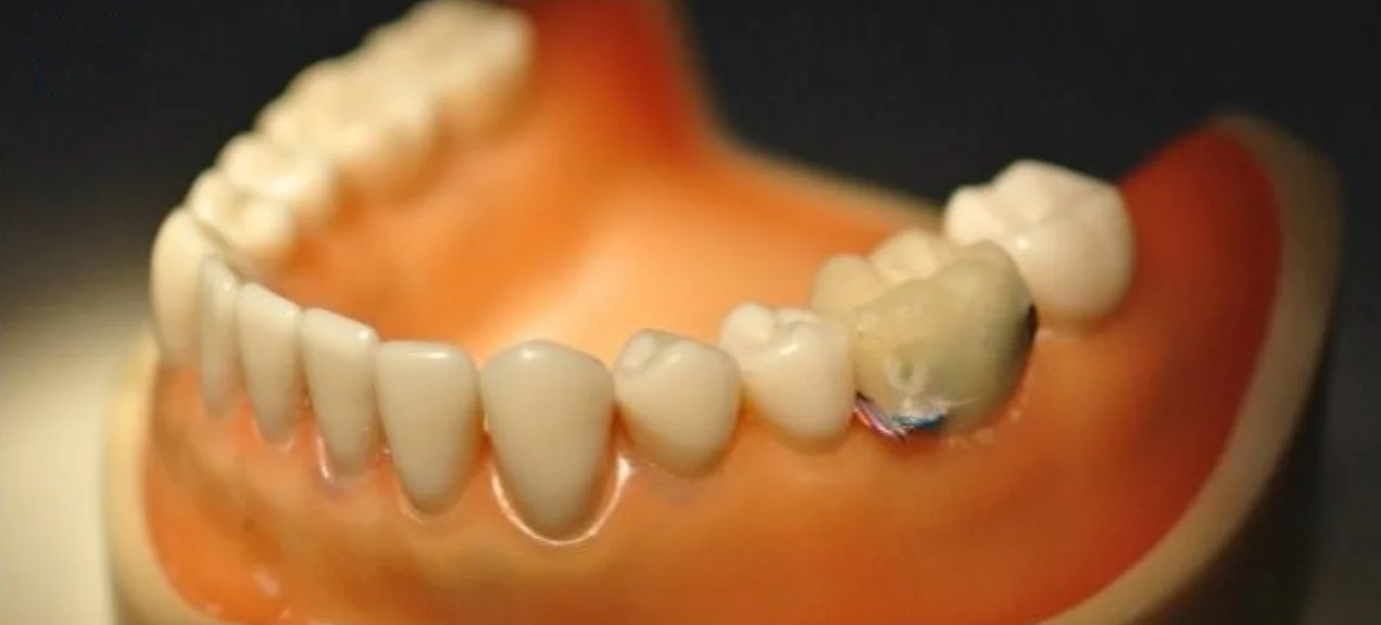 The sensor uses an accelerometer to monitor mouth activity