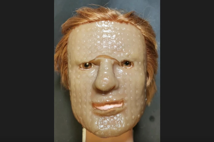 Sheets of the hydrogel material can be custom 3D-printed to match the contours of the burned body part