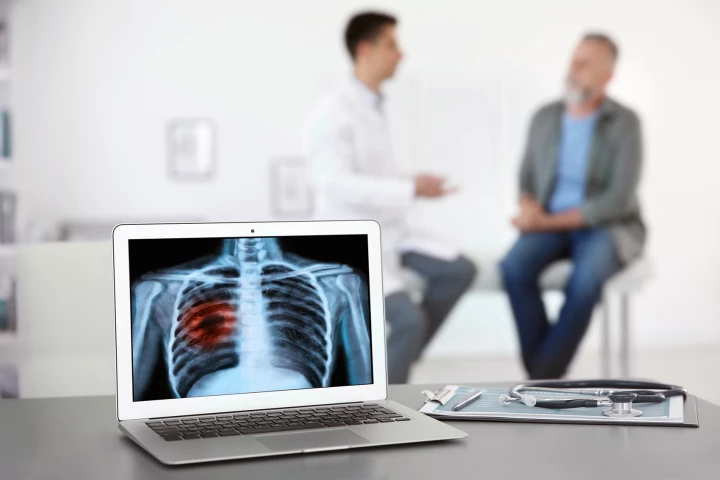 Radiation therapy offers similar long-term survival to surgery for early-stage lung cancer