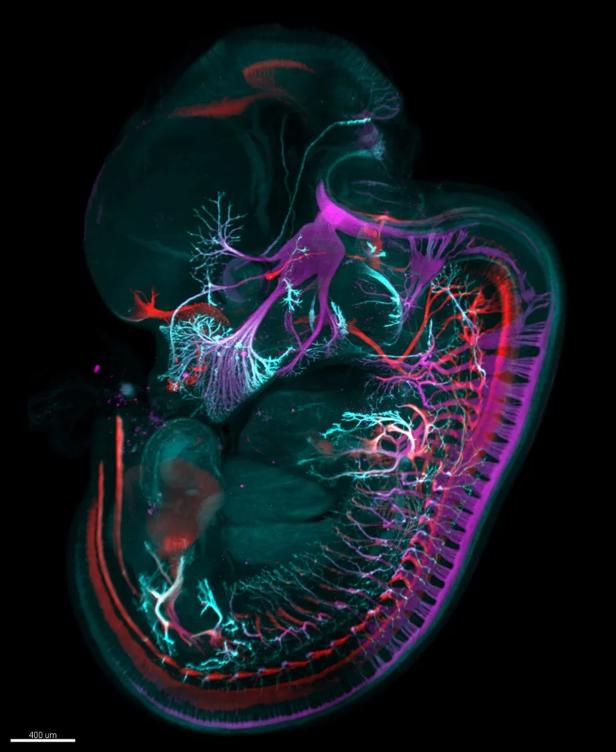 Image of Distinction: Mouse embryo (day 12.5) stained for motor (red) and sensory (magenta) nerves and nerve endings (cyan)