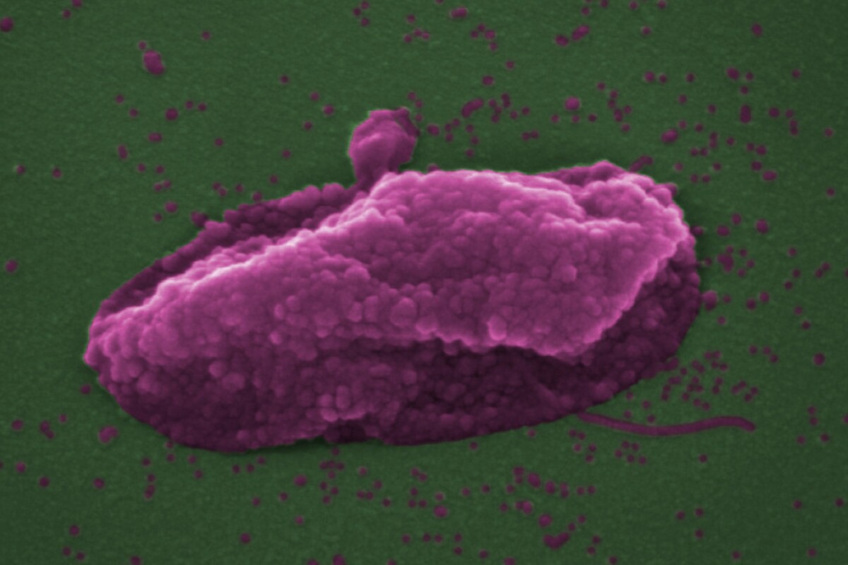 The superbug Pseudomonas aeruginosa, after being "popped like a balloon"