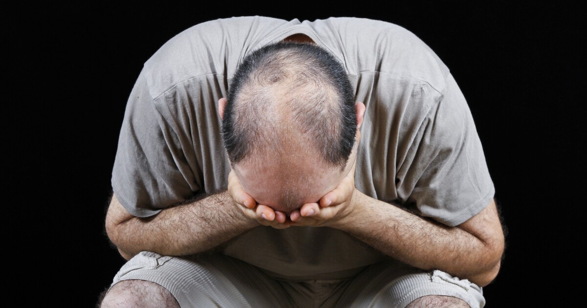 Popular hairloss drug Propecia could be linked to longterm mojo meltdown