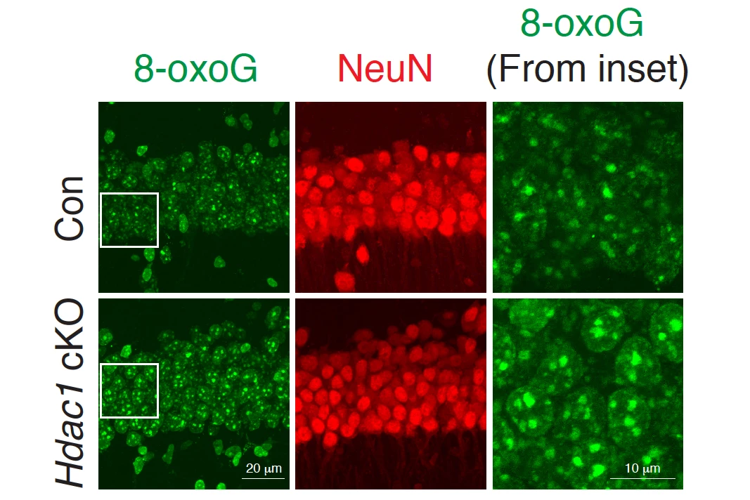 Eliminating the enzyme HDAC1 (bottom row) results in higher levels of DNA damage (green dots)