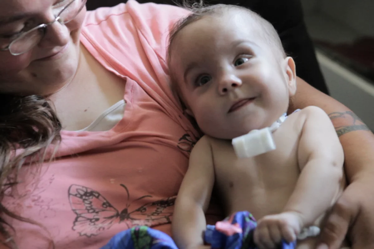 Kaiba Gionfriddo, seen here with a ventilator attachment, is the recipient of a first-of-its-kind tracheal splint