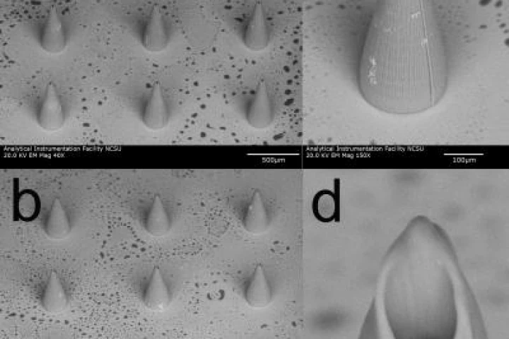 Hollow microneedles open the door to new techniques for diagnosing and treating a variety of medical conditions (Image: Roger Narayan, Faraday Discussions - Reproduced by permission of the Royal Society of Chemistry)