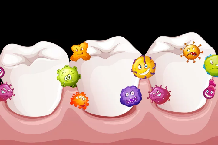 There is a hypothesis that the bacteria that causes gum disease can travel into the brain and promote inflammation and neurodegeneration, resulting in Alzheimer's disease
