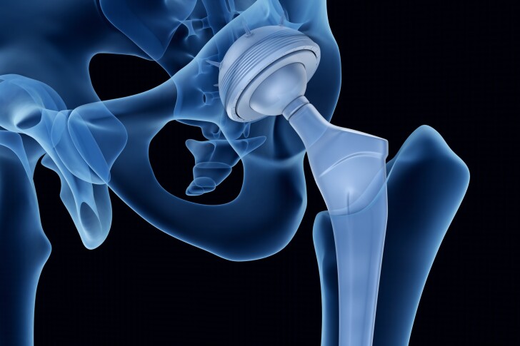 A newly developed biomaterial promises to aid the long-term success of hip implants