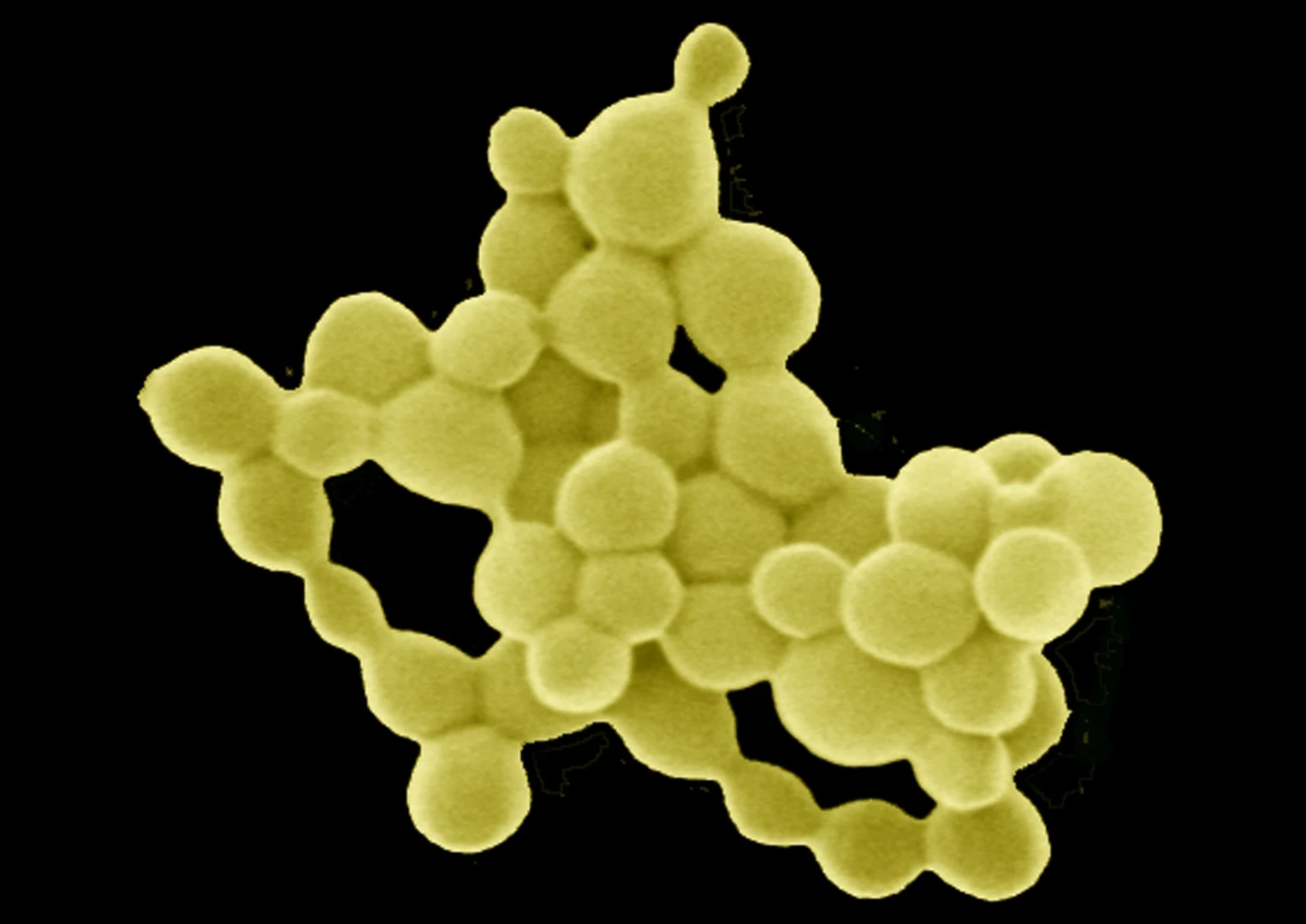 German and Australian researchers have figured out how a bacteria called C. metallidurans can consume toxic metals and excrete tiny gold nuggets, like that shown here