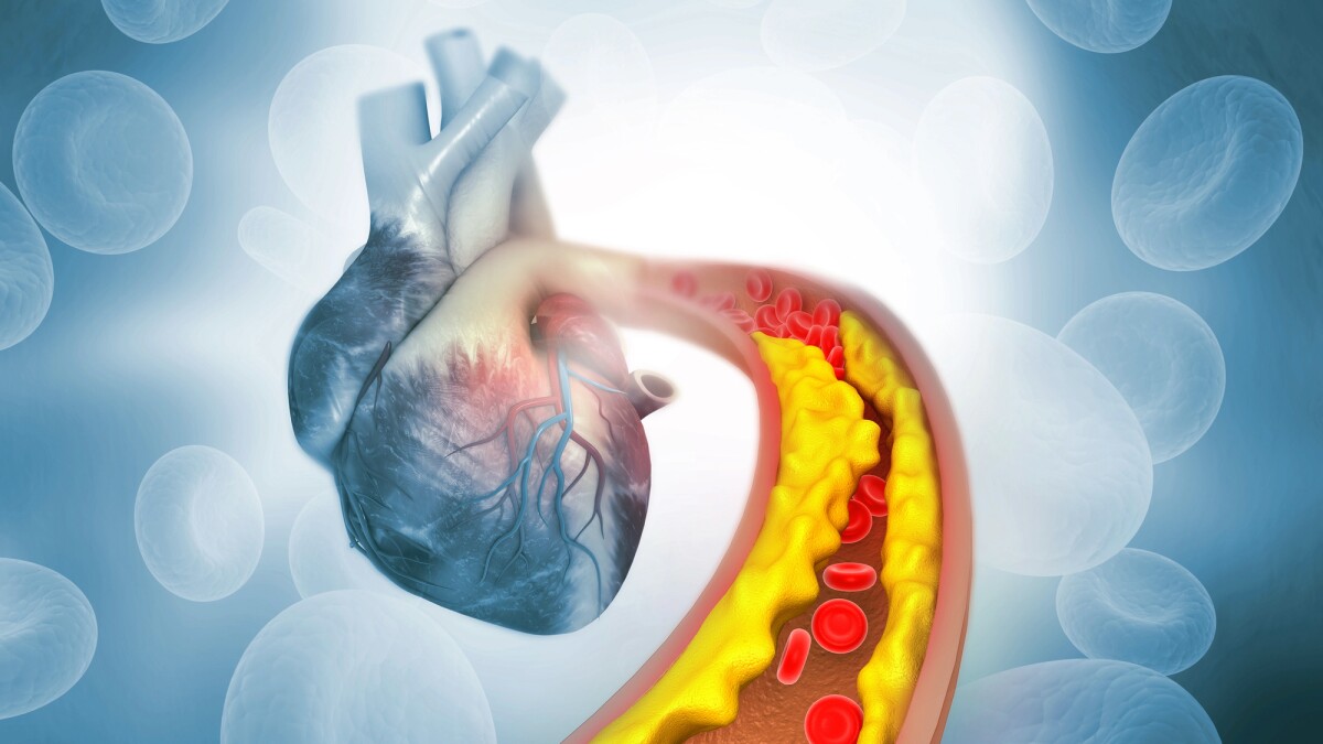 One-off lipid-lowering gene therapy a success in world-first human trial