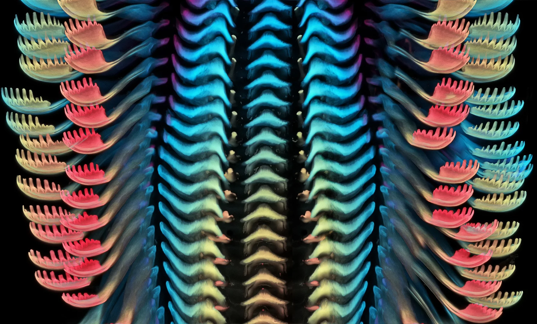 3rd Place. Tongue (radula) of a freshwater snail