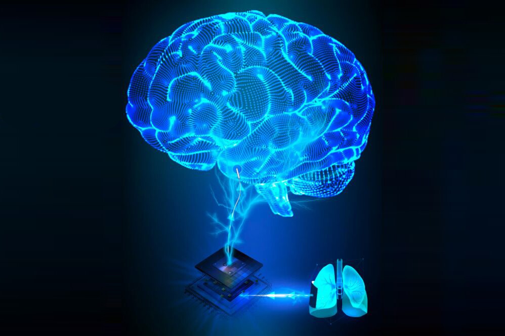 Artist's impression of a new breathing-powered brain implant