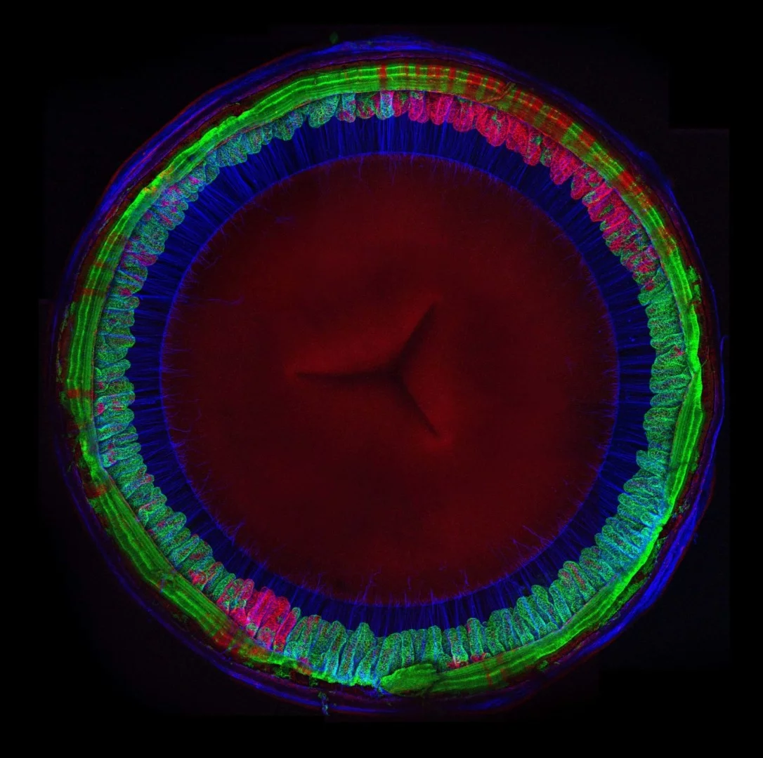 Image of Distinction: The interior of a mouse eye, showing the lens in the middle and the fibers around the edge that hold it in place