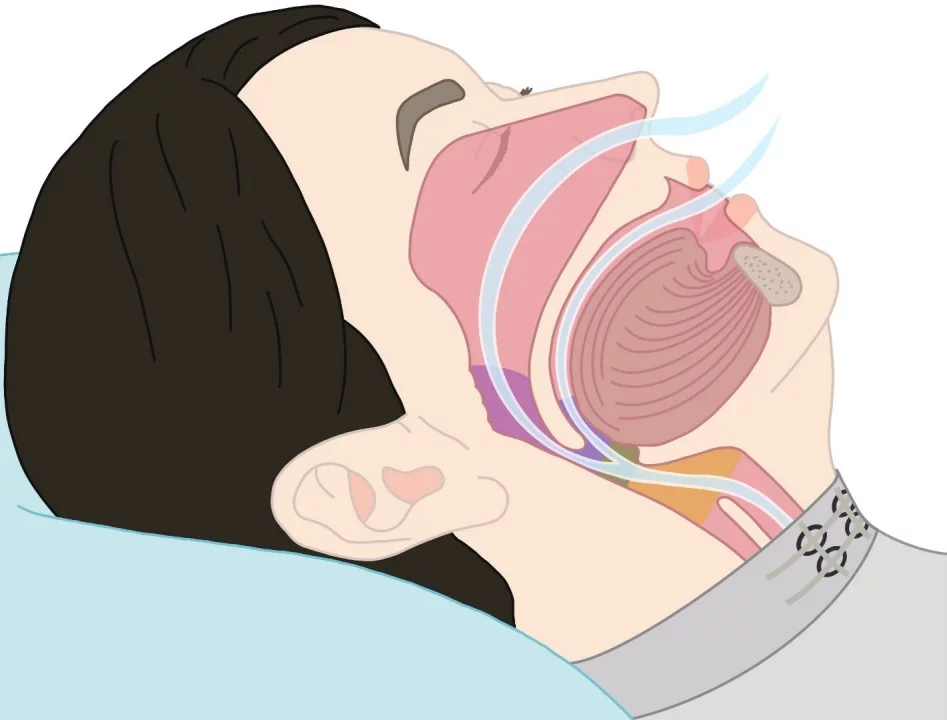 The garment's sensors detect the subtle vibrations that are transmitted to the extrinsic laryngeal muscles (in the neck) from other anatomical locations including the velum, oropharynx, tongue, and epiglottis