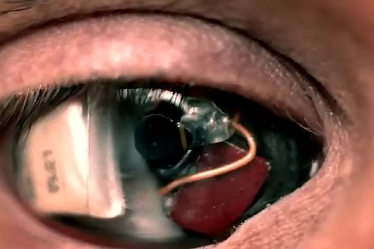 Film-maker Rob Spence has announced that his 'Camera Eye' is now fully functioning (Image: Rob Spence)