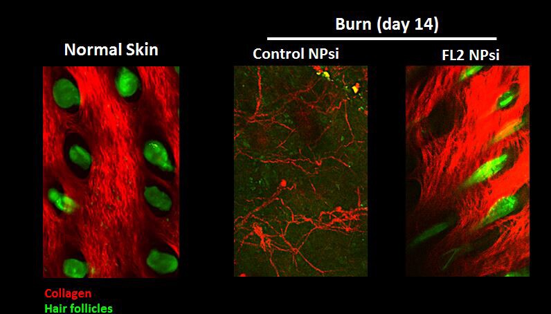 Mice treated with the FL2-inhibiting nanoparticles had burns heal 50 percent faster than those without, and the healing extended to collagen and hair follicle formation (Image: Vera DesMarais/Albert Einstein College of Medicine)