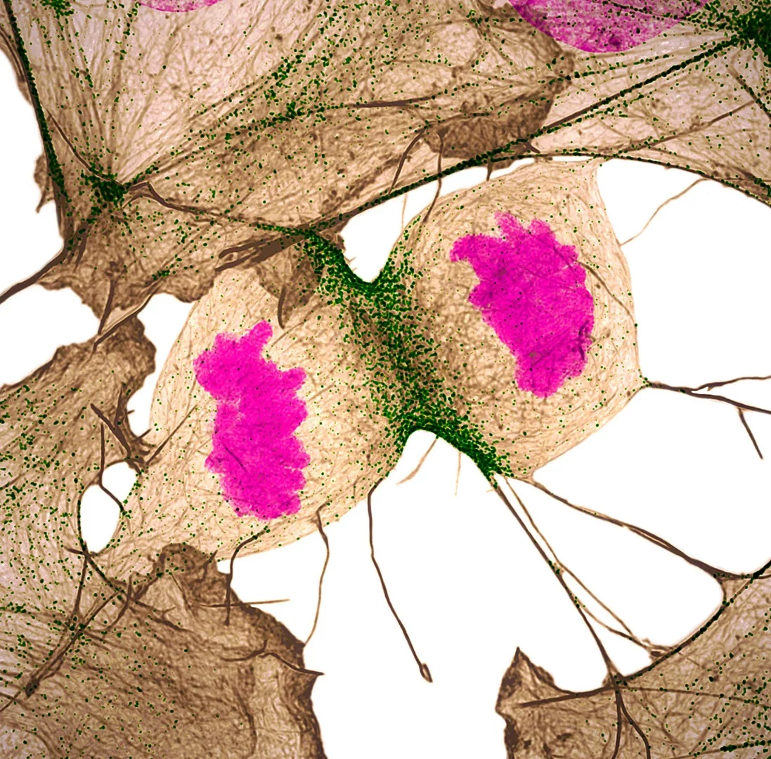 11th Place, Human fibroblast undergoing cell division, showing actin (gray), myosin II (green) and DNA (magenta)