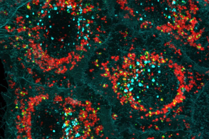 Researchers have discovered the mechanism by which the protein optineurin creates 'garbage bags' (green) around damaged mitochondria (red), marking them for removal