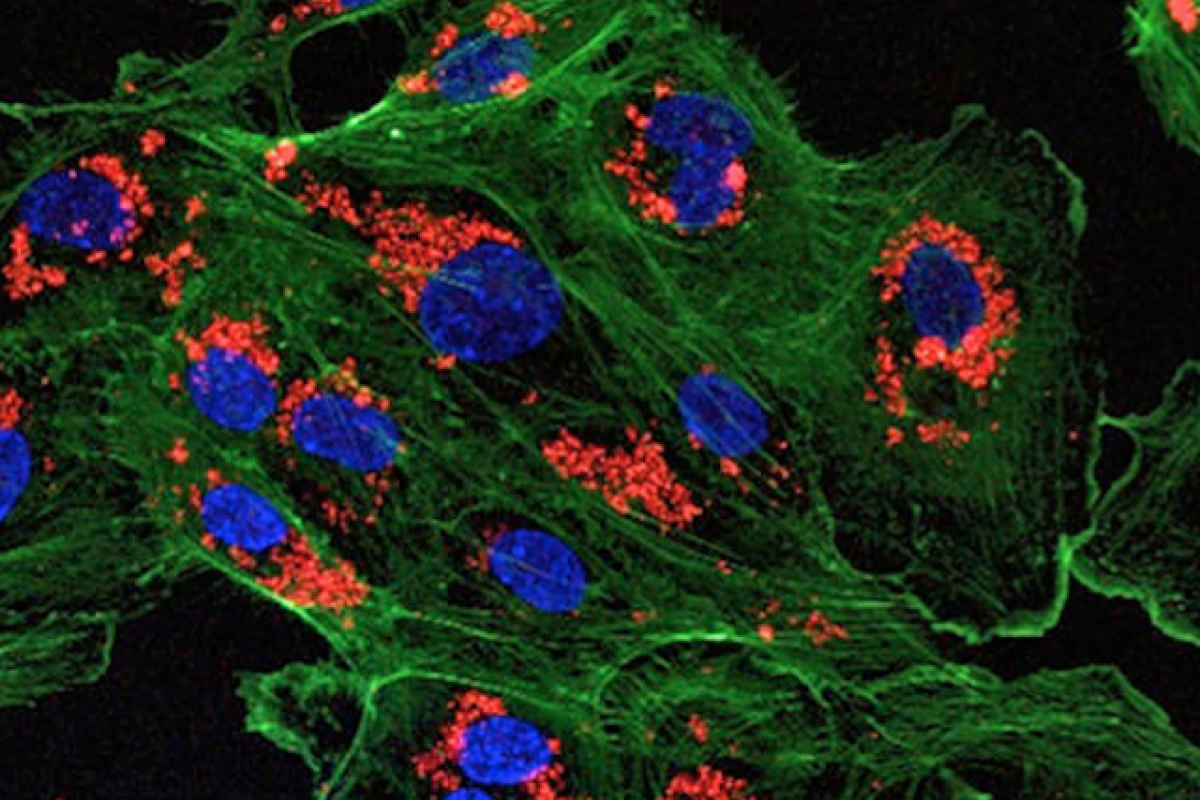 A microscopic image of endothelial cells treated with drug-loaded nanoparticles