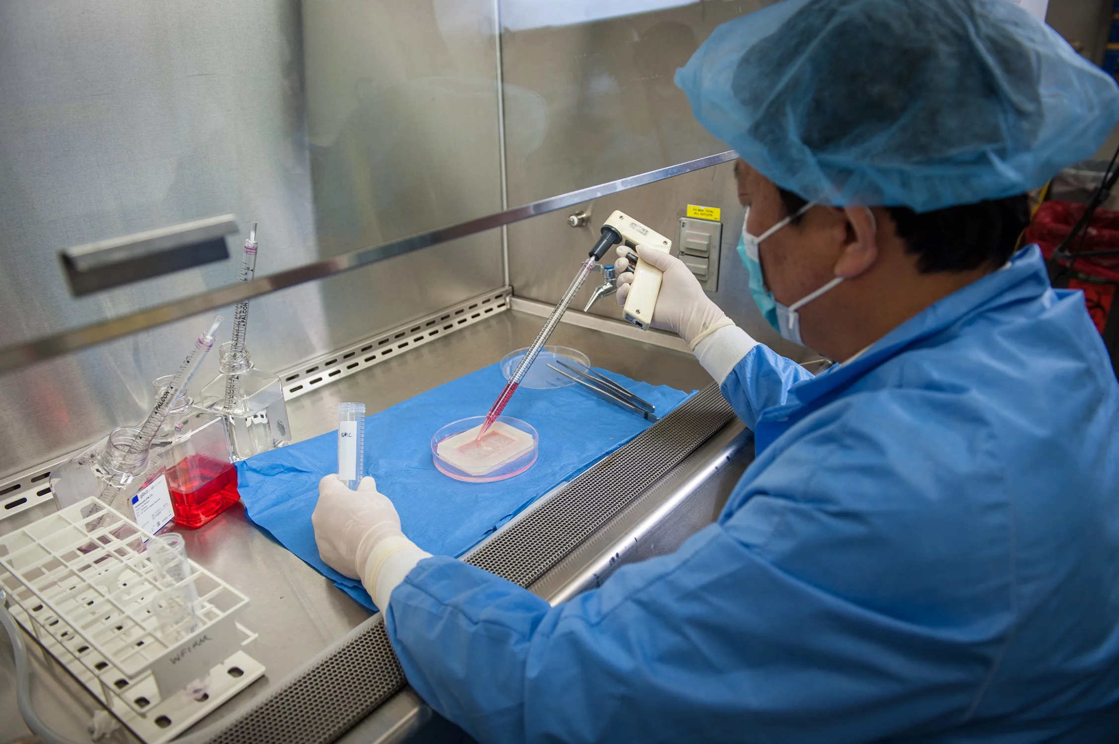 The other side of the scaffold is then coated with smooth muscle cells