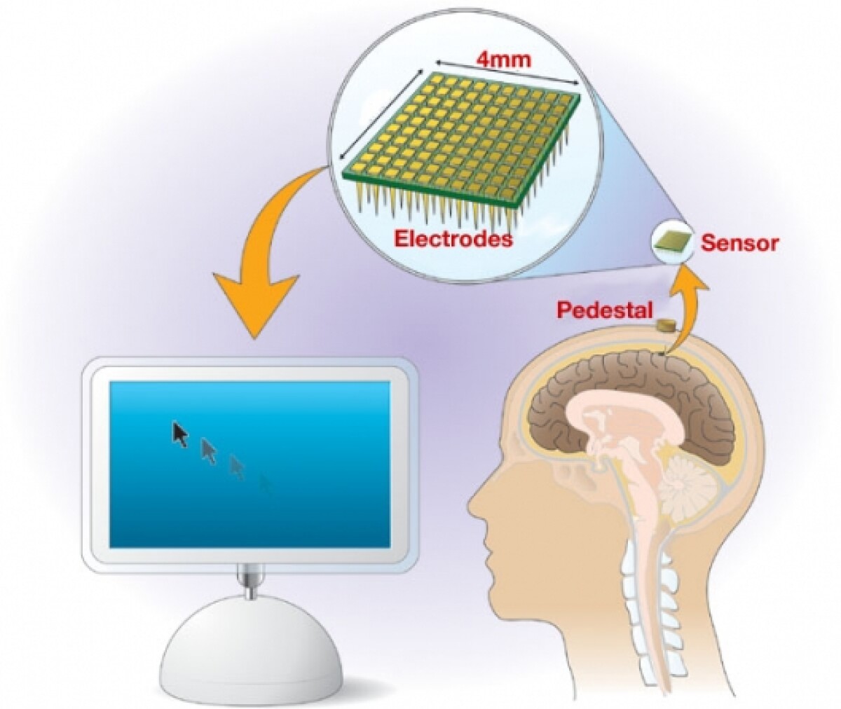 'BrainGate' BrainMachineInterface takes shape