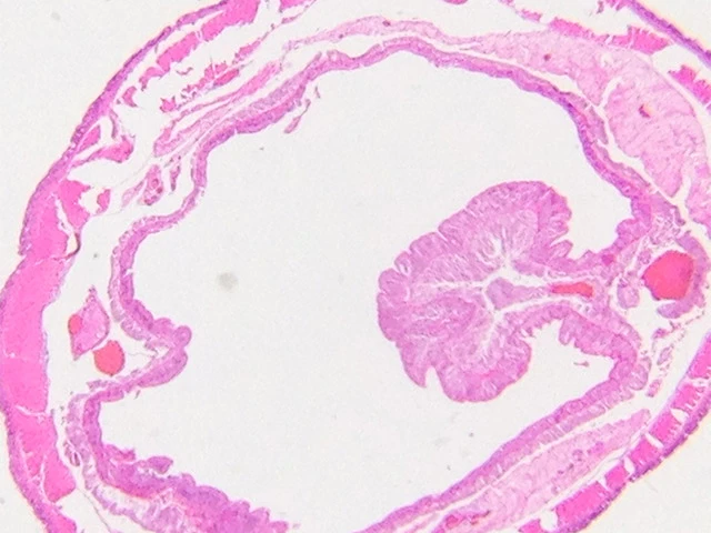 A cross-section of an earthworm, imaged at 80X magnification using the ProScope Micro Mobile