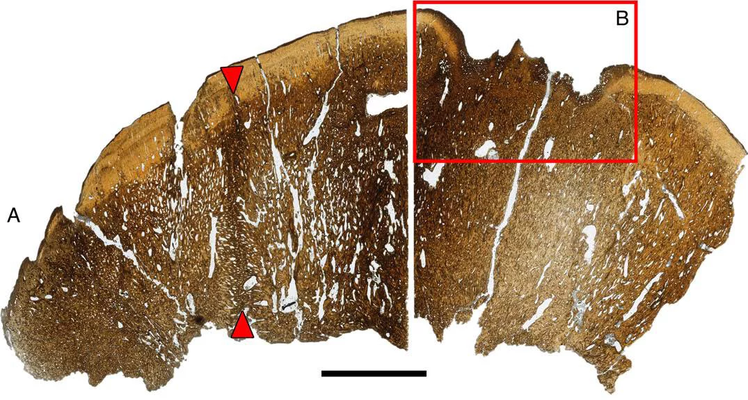 A section of the Platytholus skull, showing an injury that had partially healed by the time of death