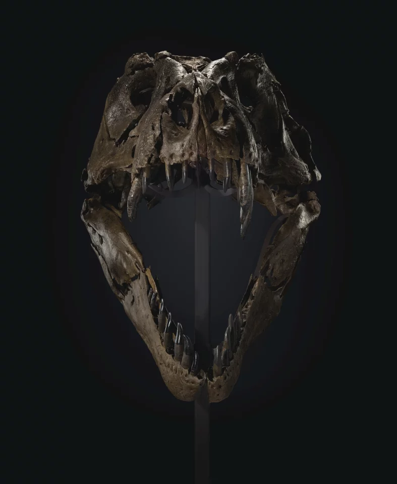 Stan sports some battle scars on on his rib, jaw and skull