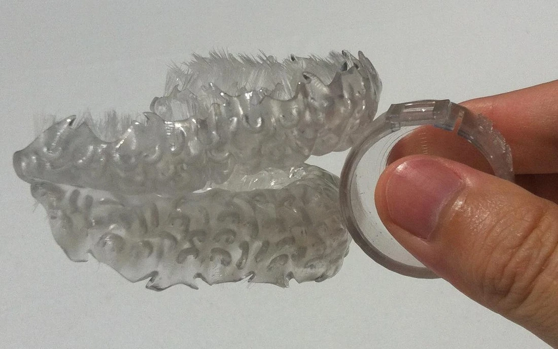The Blizzident toothbrush is actually a bristle laden mold tailored to your teeth