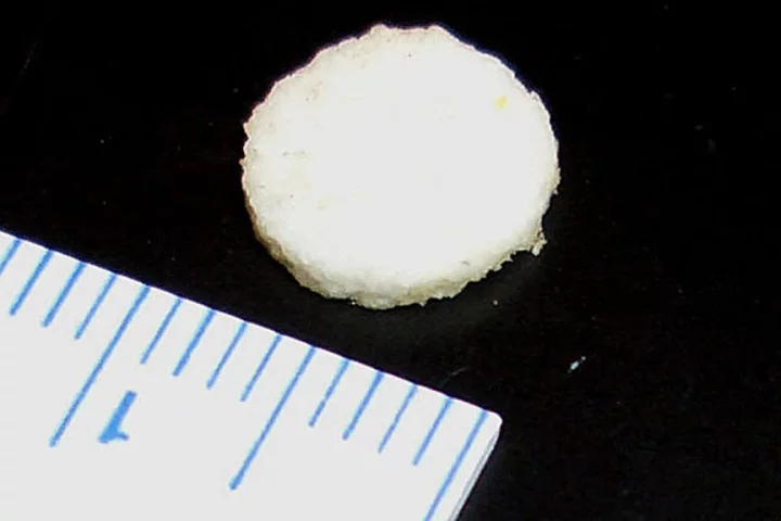 A polymer implant, 8.5 mm in diameter, is embedded with chemical signals that encourage immune cells to attack tumors