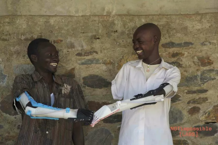 A team of experts from various fields were able to develop a prosthetic arm that could be made cheaply using 3D printing technology