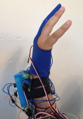 A group of graduate students created the Glove Tricorder, which equips a doctor's hand with numerous sensors to augment the typical physical exam