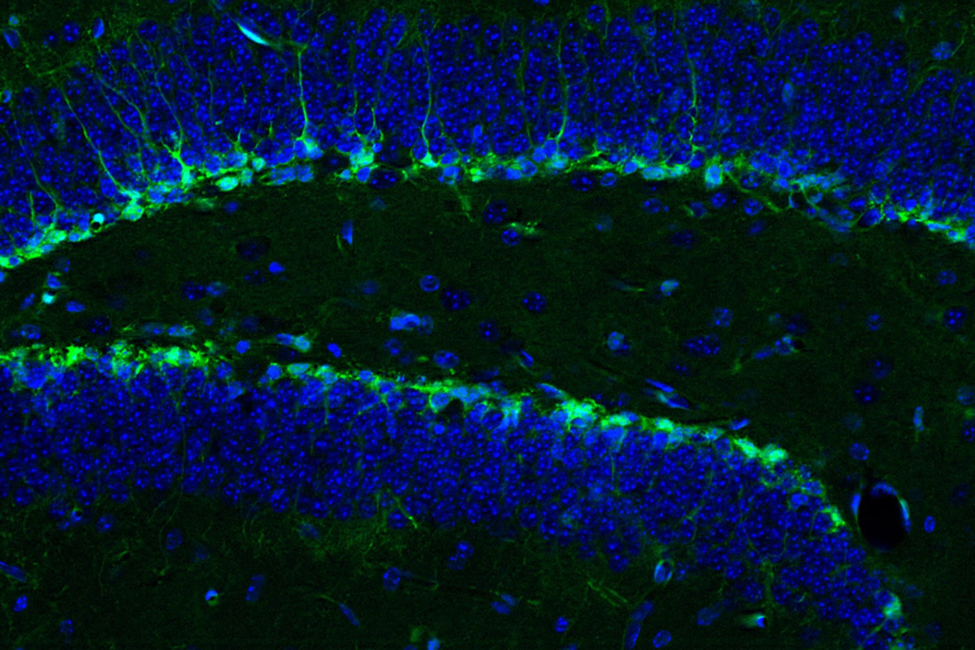 Researchers have found that a chemical produced by platelets can rejuvenate cells in aged mouse brains, just like exercise does