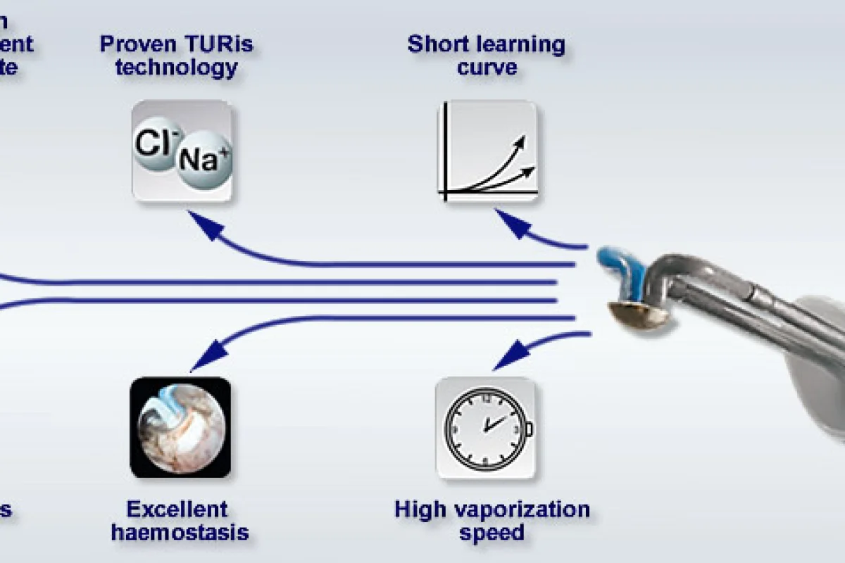 Prostate Button Plasma therapy offers less invasive treatment for enlarged prostate