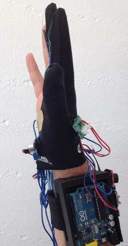 The glove could become a useful tool for basic medical needs from assessing sports injuries in the middle of a game to performing quick check ups at home