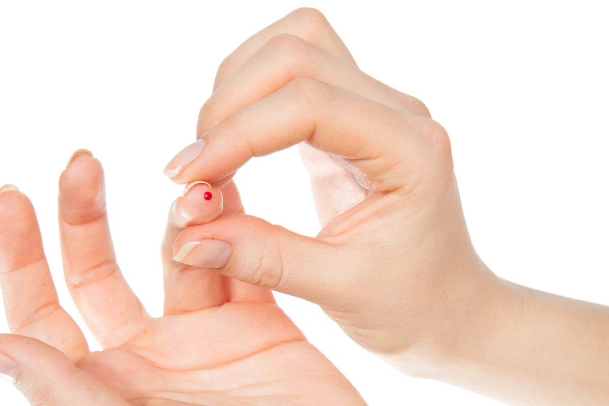 Researchers have developed a technique that allows stem cells to be created from less than a drop of blood (Photo: Shutterstock)