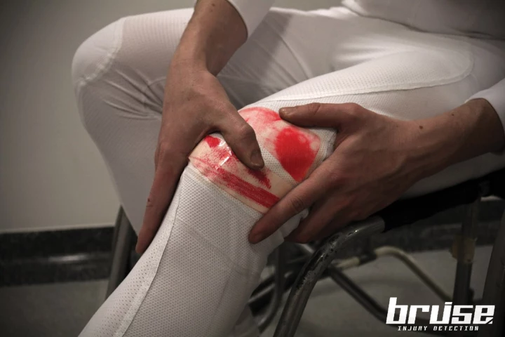 The bruise trousers release magenta dye when subjected to impact (Photo: Lucy Jung, Ming Kong, Elena Dieckmann and Dan Garrett/Imperial College London)